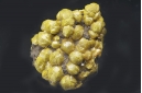 Mimetite Var. Campylite